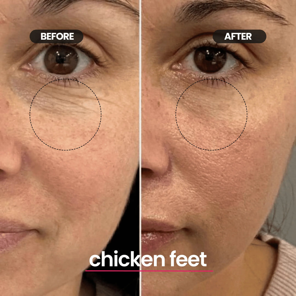 Rivelly© LED Mask SilkDerm™ - Rivelly