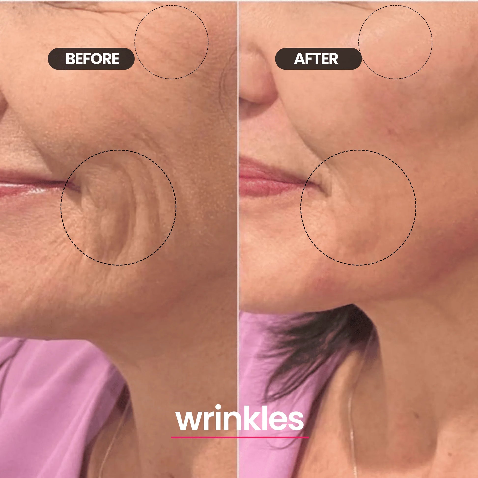 Rivelly© LED Mask SilkDerm™ - Rivelly