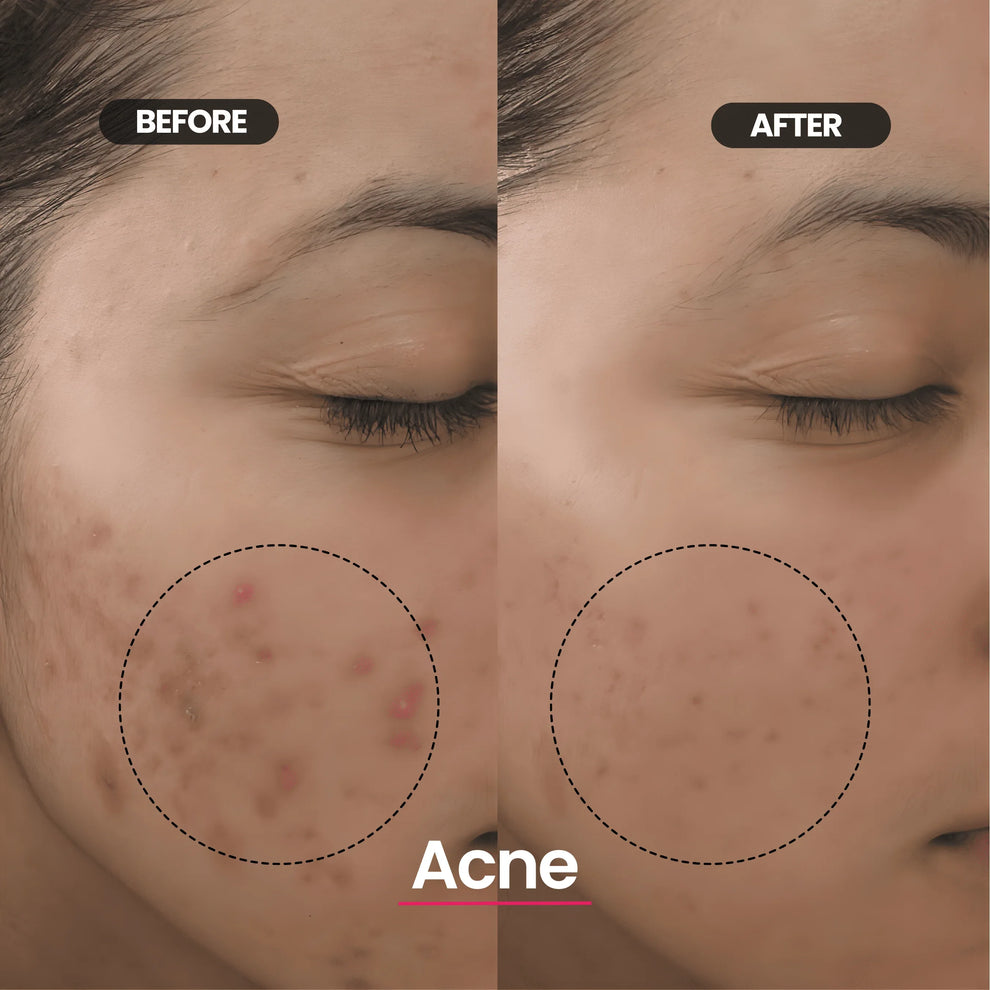 Rivelly© LED Mask SilkDerm™ - Rivelly