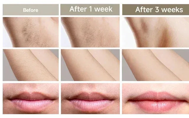 Rivelly© LuméaSkin™ Pro - Rivelly